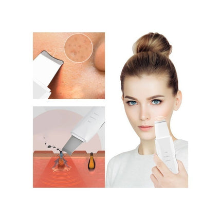 Limpiador Ultrasonico Masaje Facial Digital Peeling Lifting