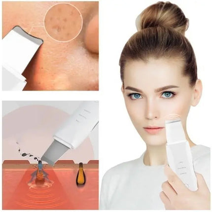 Limpiador Ultrasonico Masaje Facial Digital Peeling Lifting